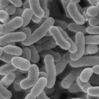 Lactobacillus_TEM